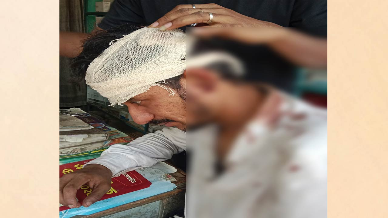 বগুড়ার শেরপুরে তুচ্ছ ঘটনায় যুবককে কুপিয়ে জখম