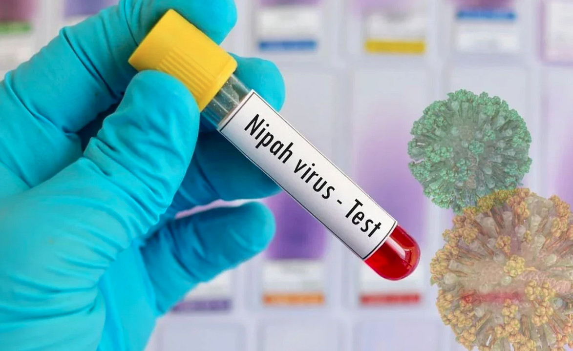 নিপা ভাইরাসে দেশে এ বছরের ‘প্রথম মৃত্যু’