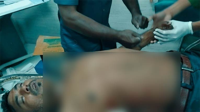 বগুড়ায় হত্যাসহ একাধিক মামলার আসামিকে তুলে নিয়ে হাত-পা ভেঙে দিলো দুর্বৃত্তরা