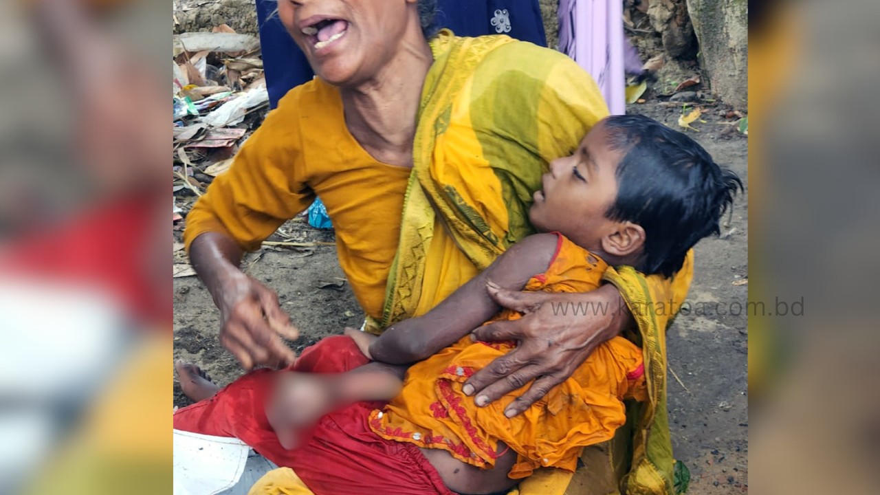 বগুড়ার আদমদীঘিতে ট্রাকের ধাক্কায় শিশু নিহত