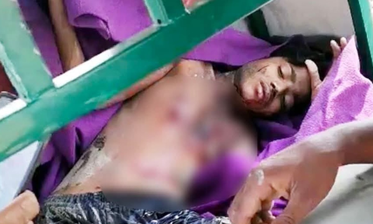 মাইন বিস্ফোরণে রোহিঙ্গা যুবক আহত