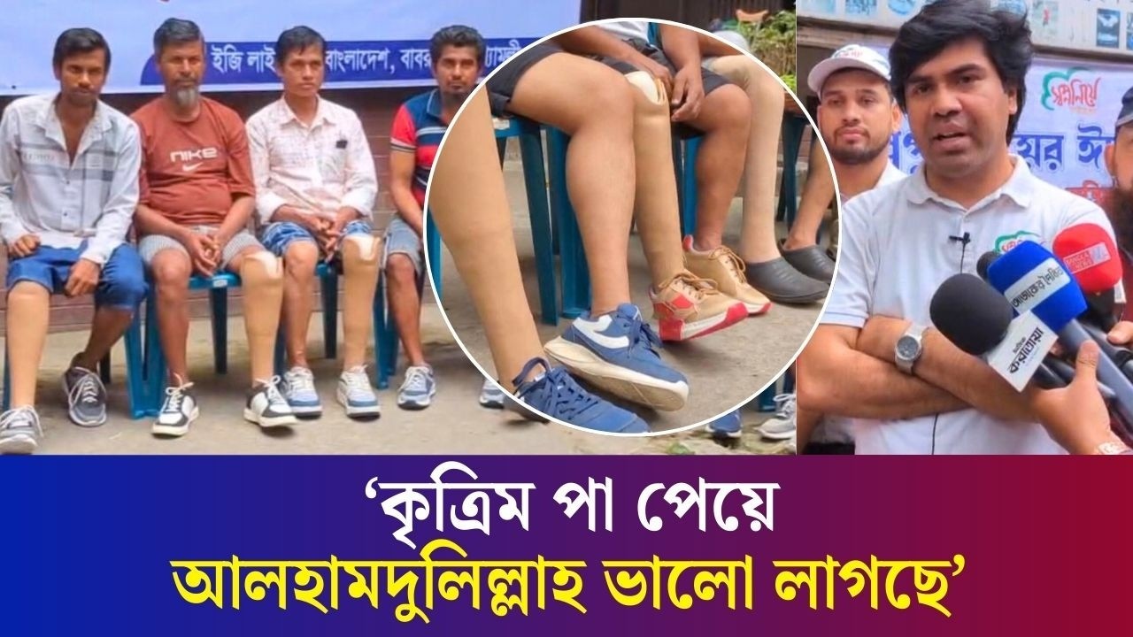 ‘টাকা পয়সা ছাড়াই কৃত্রিম পা পেলেন তারা’