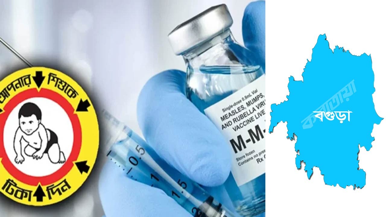 বগুড়ায় হামের টিকা পাবে সাড়ে ৩ লাখ শিশু, ক্যাম্পেইন শুরু ২০ এপ্রিল
