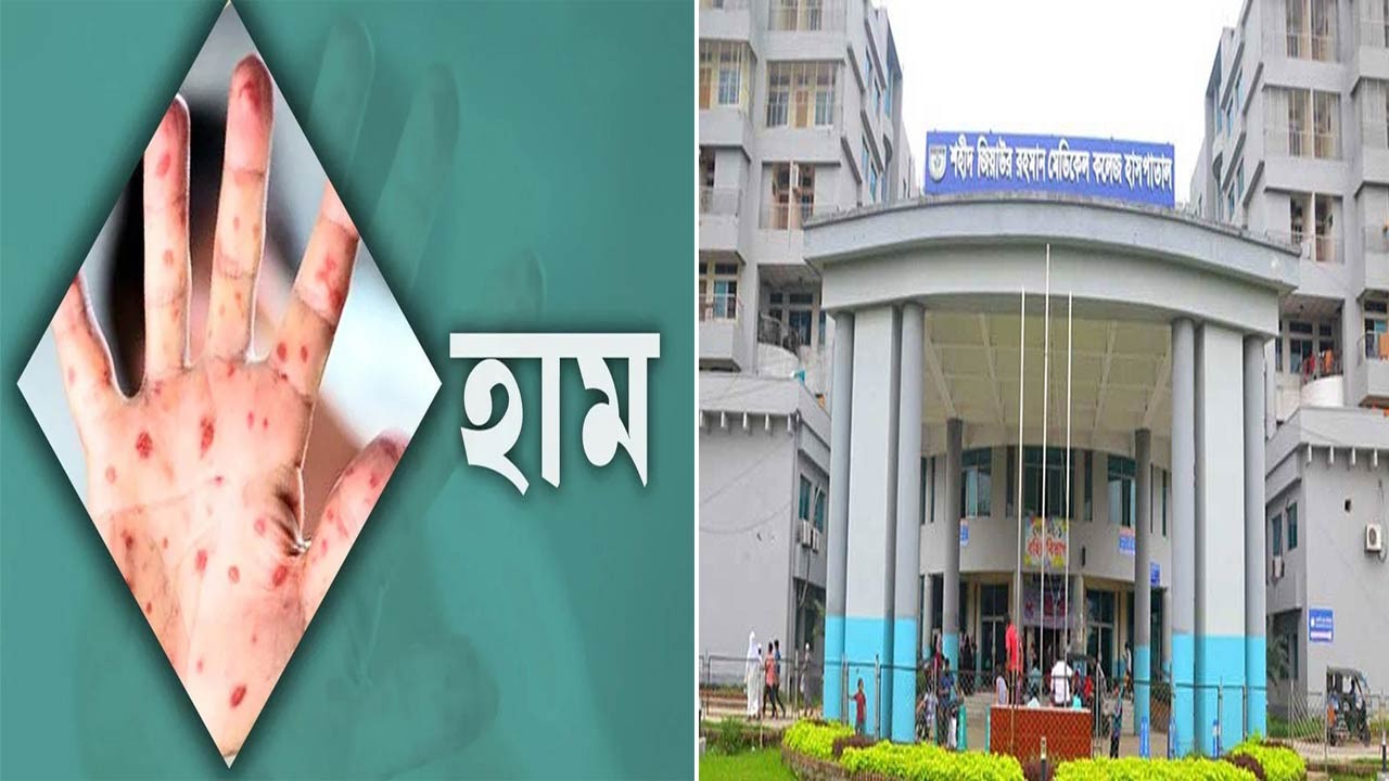 বগুড়ায় হামের উপসর্গে আরও এক শিশুর মৃত্যু, দেড় মাসে ৫ শিশু মারা গেছে