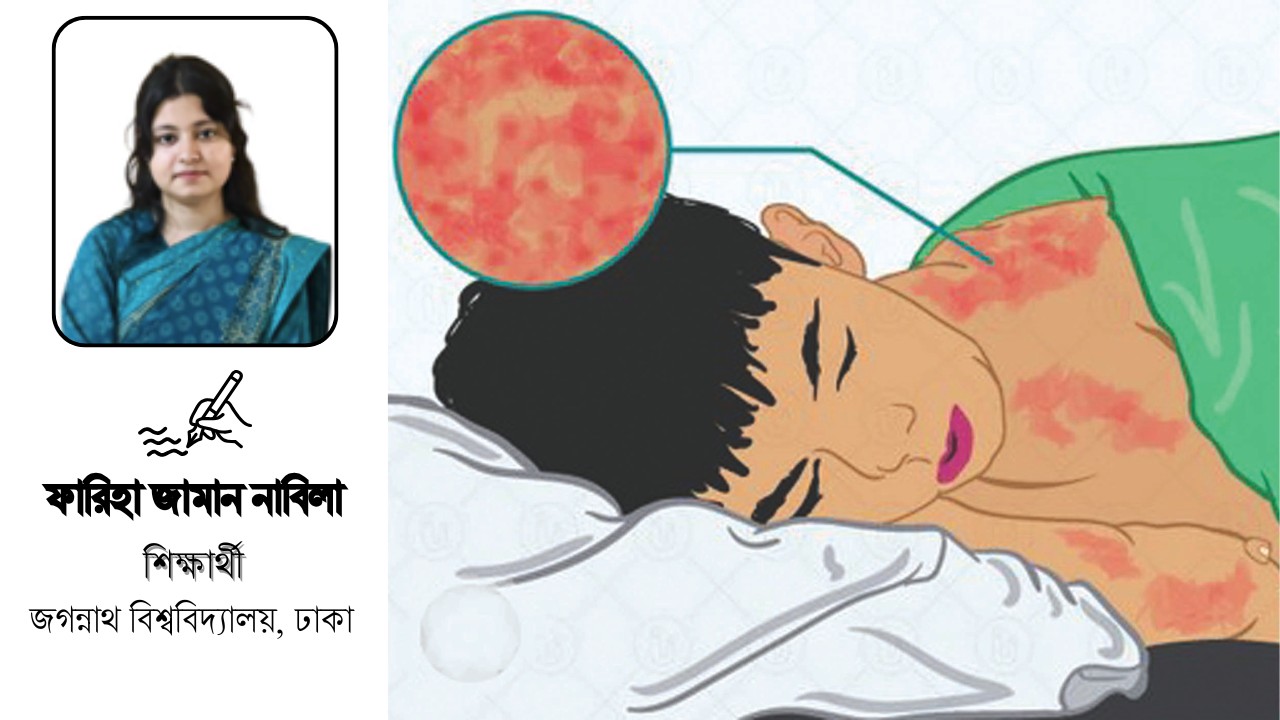 বাড়ছে হাম রোগ: প্রতিরোধ করতে করণীয়