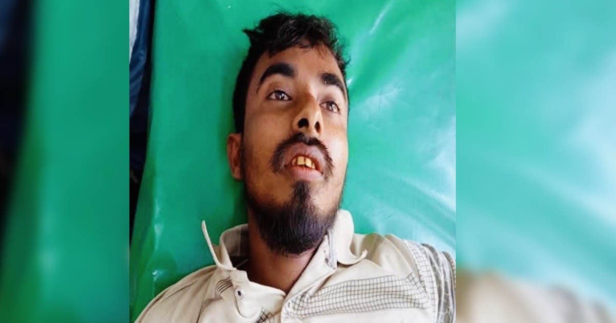 খোকসায় প্রকাশ্য বাজারে যুবককে দুর্বৃত্তদের গুলি