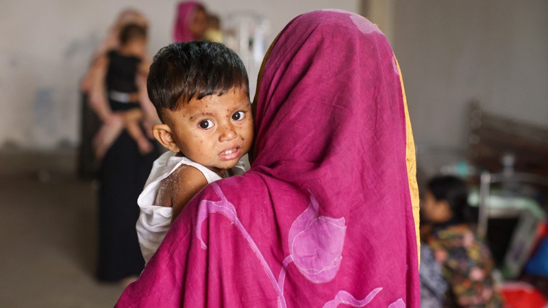 হামে ২৮ দিনে ১৬৯ শিশুর মৃত্যু