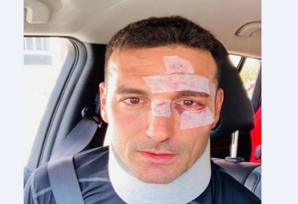 দুর্ঘটনায় আহত আর্জেন্টাইন কোচ